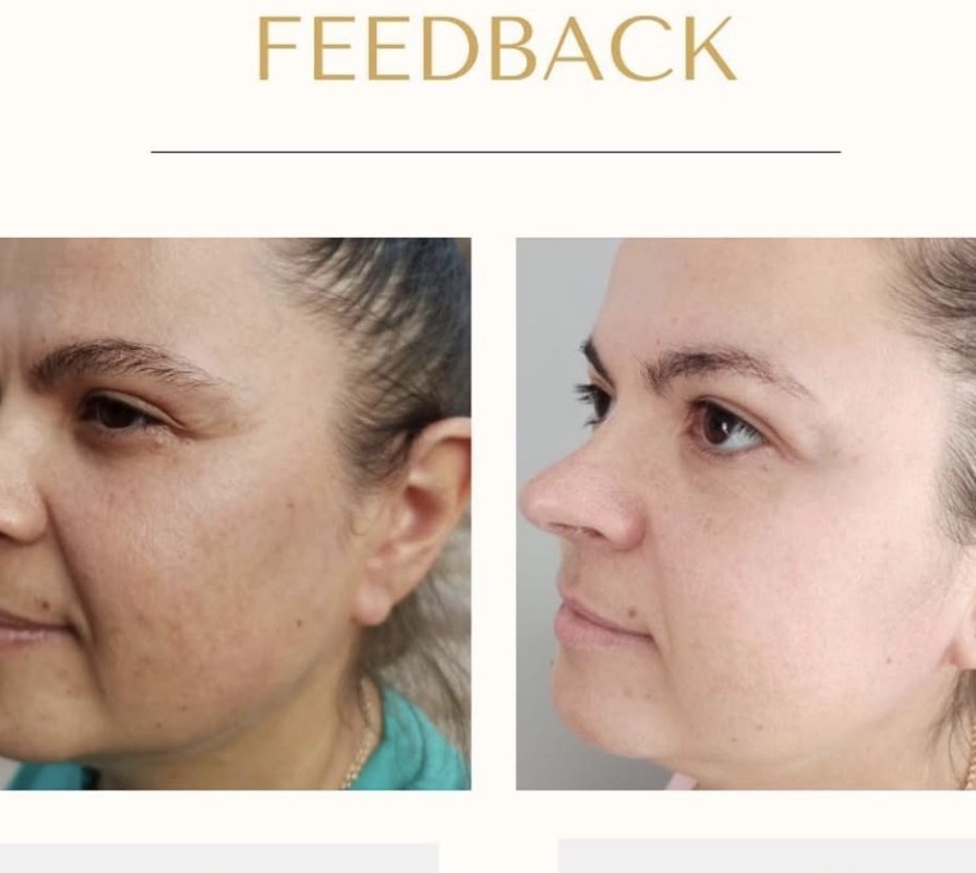 Îngrijire facială — Înainte · După (stânga → dreapta)